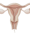 endometriyal biyopsi